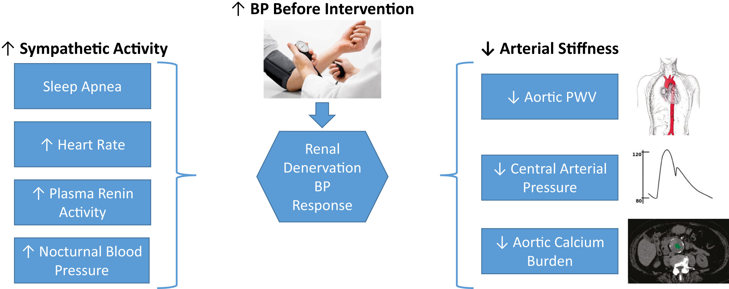 Renal Denervation: Are We There Yet?