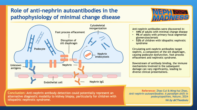 #NephMadness 2025: Minimal Change Disease Region – AJKD Blog